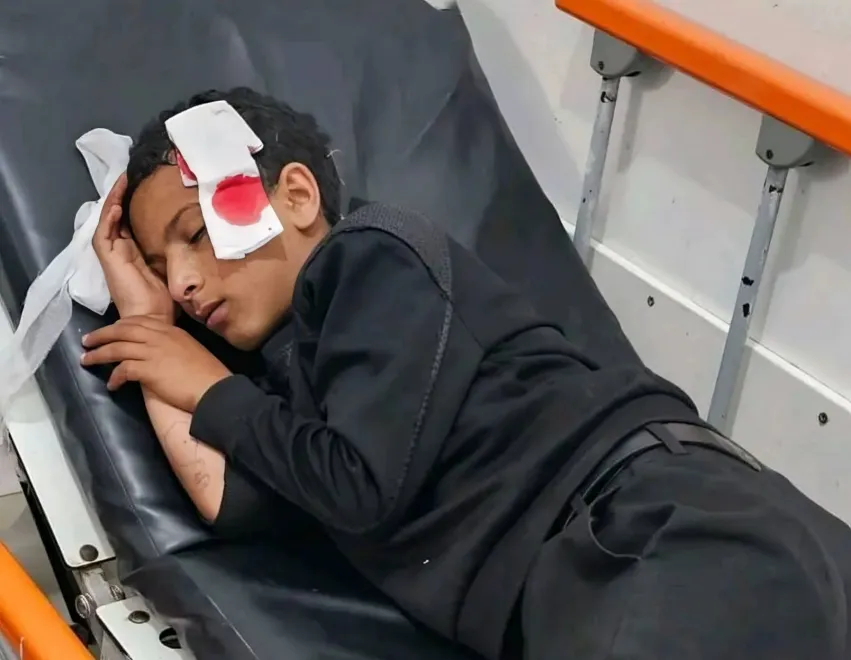 إصابة طفل برصاص قناص حوثي جنوبي شرق تعز 