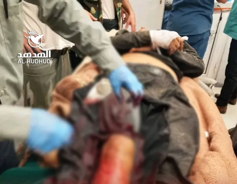 بعد أيام من مقتل طفل قنصاً..   رصاصتا قناص حوثي تُنهيا حياة سبعيني في تعز