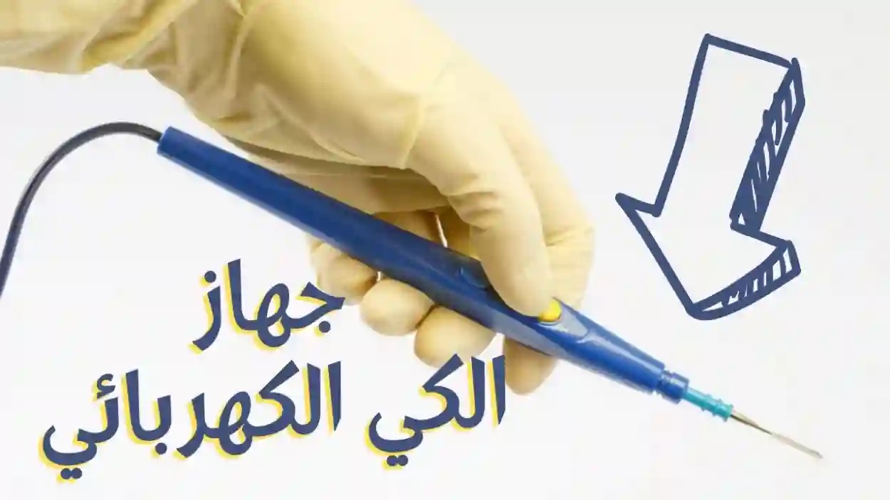 الكي